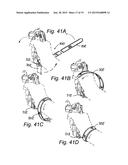 Apparatus for Prevention of Dropping of Handgun diagram and image