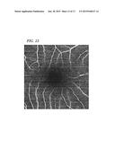 OPTICAL COHERENCE TOMOGRAPHY DEVICE diagram and image