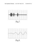 THRESHOLD BARRIER SYSTEM diagram and image