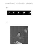 MOUSE MODEL OF AMYOTROPHIC LATERAL SCLEROSIS AND/OR FRONTOTEMPORAL LOBAR     DEGENERATION diagram and image