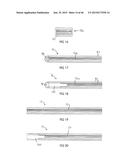 SUSPENSION DEVICE diagram and image