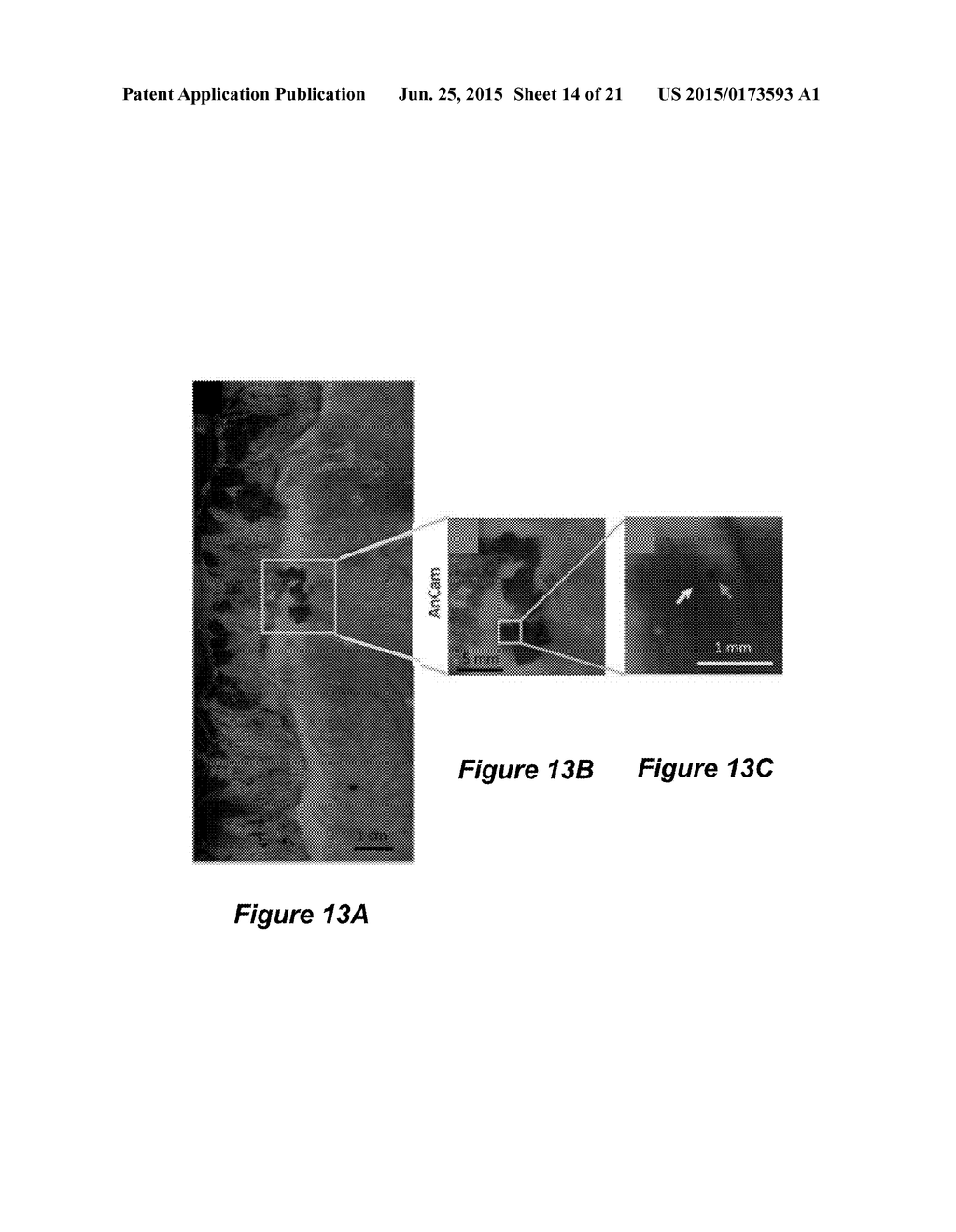 ROTATIONAL SCANNING ENDOSCOPE - diagram, schematic, and image 15