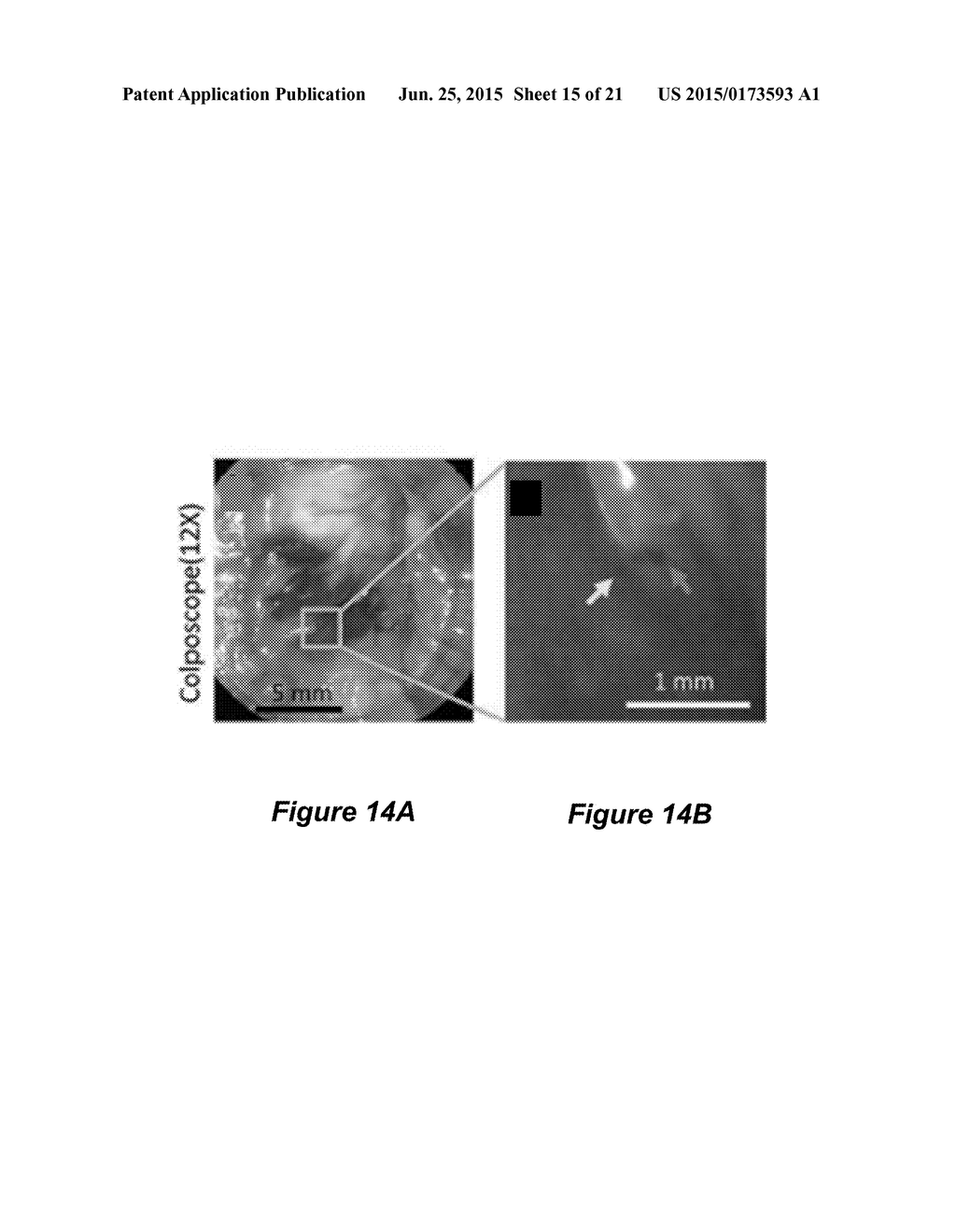 ROTATIONAL SCANNING ENDOSCOPE - diagram, schematic, and image 16