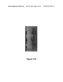 ROTATIONAL SCANNING ENDOSCOPE diagram and image