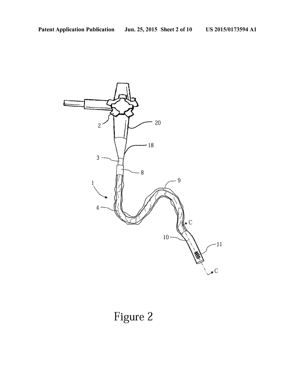 Method and Device for Improved Hygiene During Endoscopic Procedures - diagram, schematic, and image 03