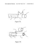 Method and Device for Improved Hygiene During Endoscopic Procedures diagram and image