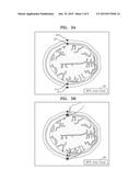 METHOD AND APPARATUS FOR INDICATING POINT WHOSE LOCATION HAS BEEN ADJUSTED     BASED ON TYPE OF CALIPER IN MEDICAL IMAGE diagram and image