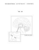 METHOD AND APPARATUS FOR INDICATING POINT WHOSE LOCATION HAS BEEN ADJUSTED     BASED ON TYPE OF CALIPER IN MEDICAL IMAGE diagram and image