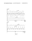 Physiological Monitoring Method and System diagram and image