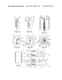 CONTROLLED SYMPATHECTOMY AND MICRO-ABLATION SYSTEMS AND METHODS diagram and image