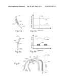 CONTROLLED SYMPATHECTOMY AND MICRO-ABLATION SYSTEMS AND METHODS diagram and image