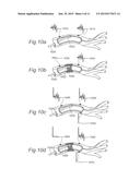 CONTROLLED SYMPATHECTOMY AND MICRO-ABLATION SYSTEMS AND METHODS diagram and image