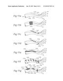 CONTROLLED SYMPATHECTOMY AND MICRO-ABLATION SYSTEMS AND METHODS diagram and image