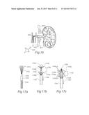 CONTROLLED SYMPATHECTOMY AND MICRO-ABLATION SYSTEMS AND METHODS diagram and image