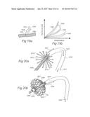 CONTROLLED SYMPATHECTOMY AND MICRO-ABLATION SYSTEMS AND METHODS diagram and image