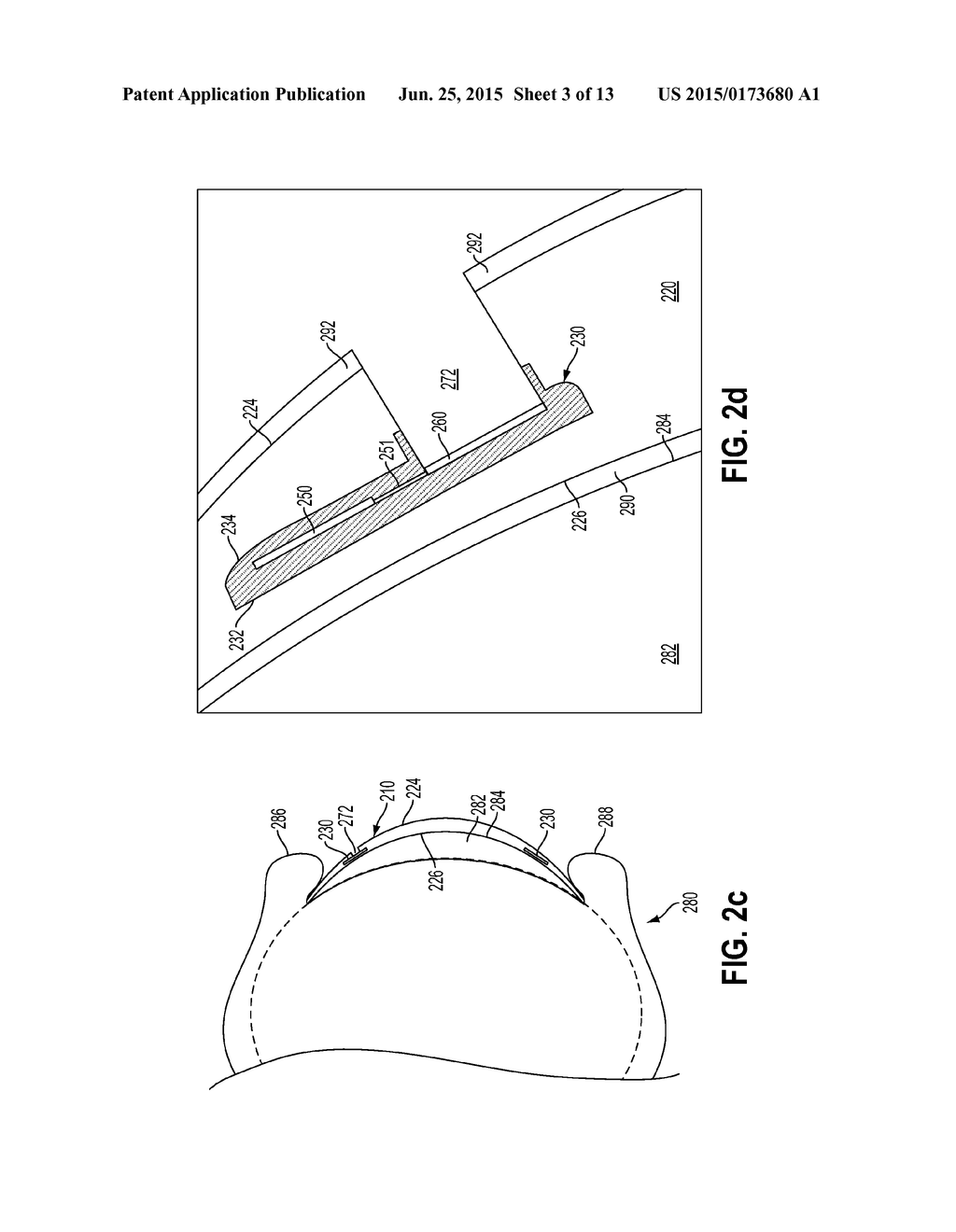 Sensor Electrodes in a Bio-compatible Device - diagram, schematic, and image 04