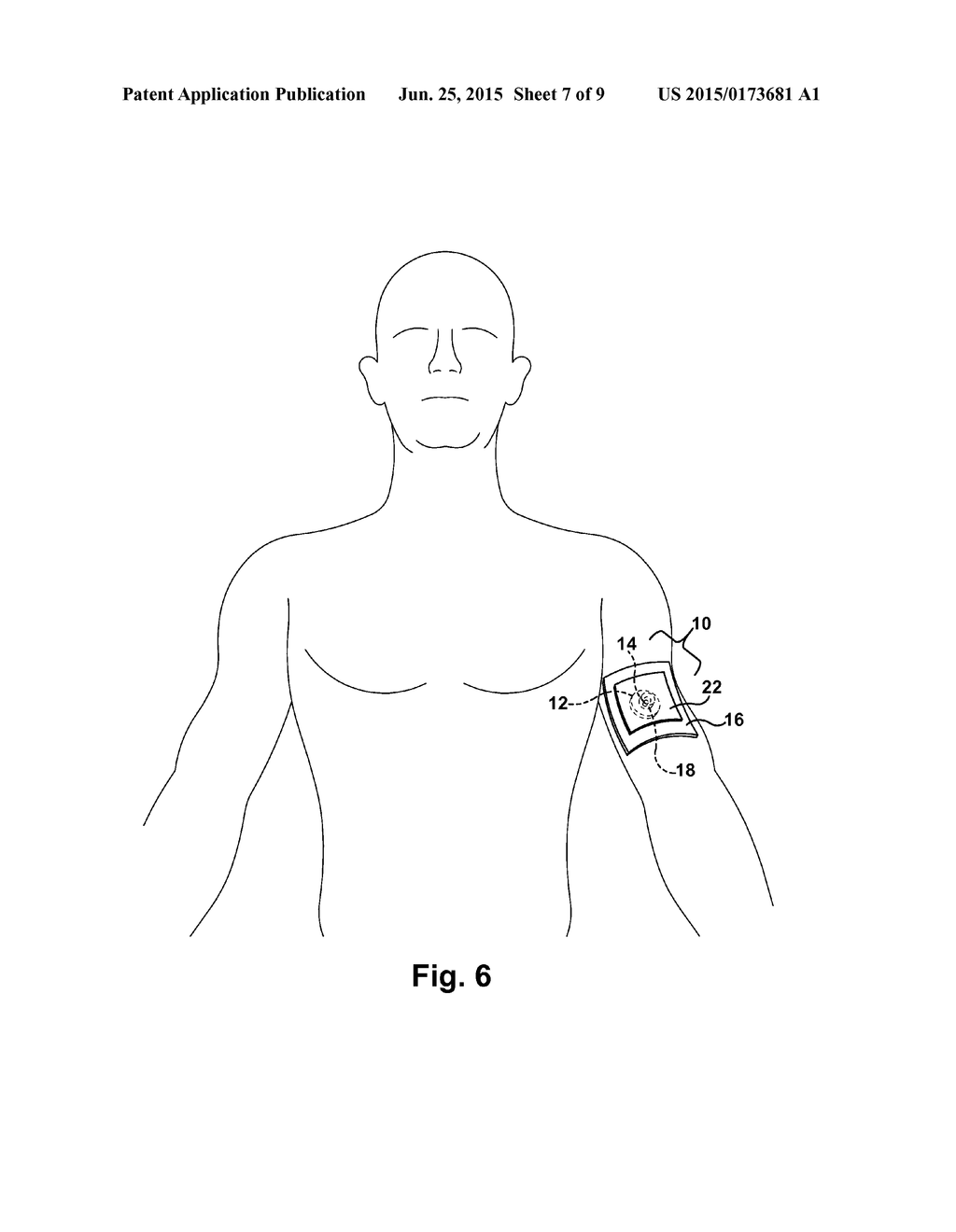 MOBILE TRANSDUCER HOLDER ASSEMBLY - diagram, schematic, and image 08