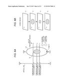 LESION DETERMINATION APPARATUS, SIMILAR CASE SEARCHING APPARATUS, LESION     DETERMINATION METHOD, SIMILAR CASE SEARCHING METHOD, AND NON-TRANSITORY     COMPUTER-READABLE STORAGE MEDIUM diagram and image