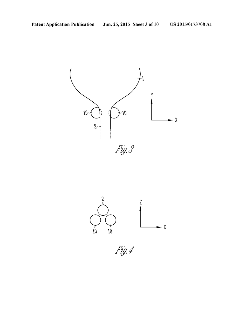 METHOD AND APPARATUS FOR PLACEMENT OF IMPLANTABLE DEVICE ADJACENT A BODY     LUMEN - diagram, schematic, and image 04