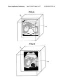 ULTRASOUND DIAGNOSTIC APPARATUS, MEDICAL IMAGE PROCESSING APPARATUS AND     IMAGE PROCESSING METHOD diagram and image