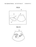 ULTRASOUND DIAGNOSTIC APPARATUS, MEDICAL IMAGE PROCESSING APPARATUS AND     IMAGE PROCESSING METHOD diagram and image