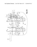 Suture Passer With Tissue Reinforcement Positioner diagram and image