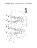 Suture Passer With Tissue Reinforcement Positioner diagram and image