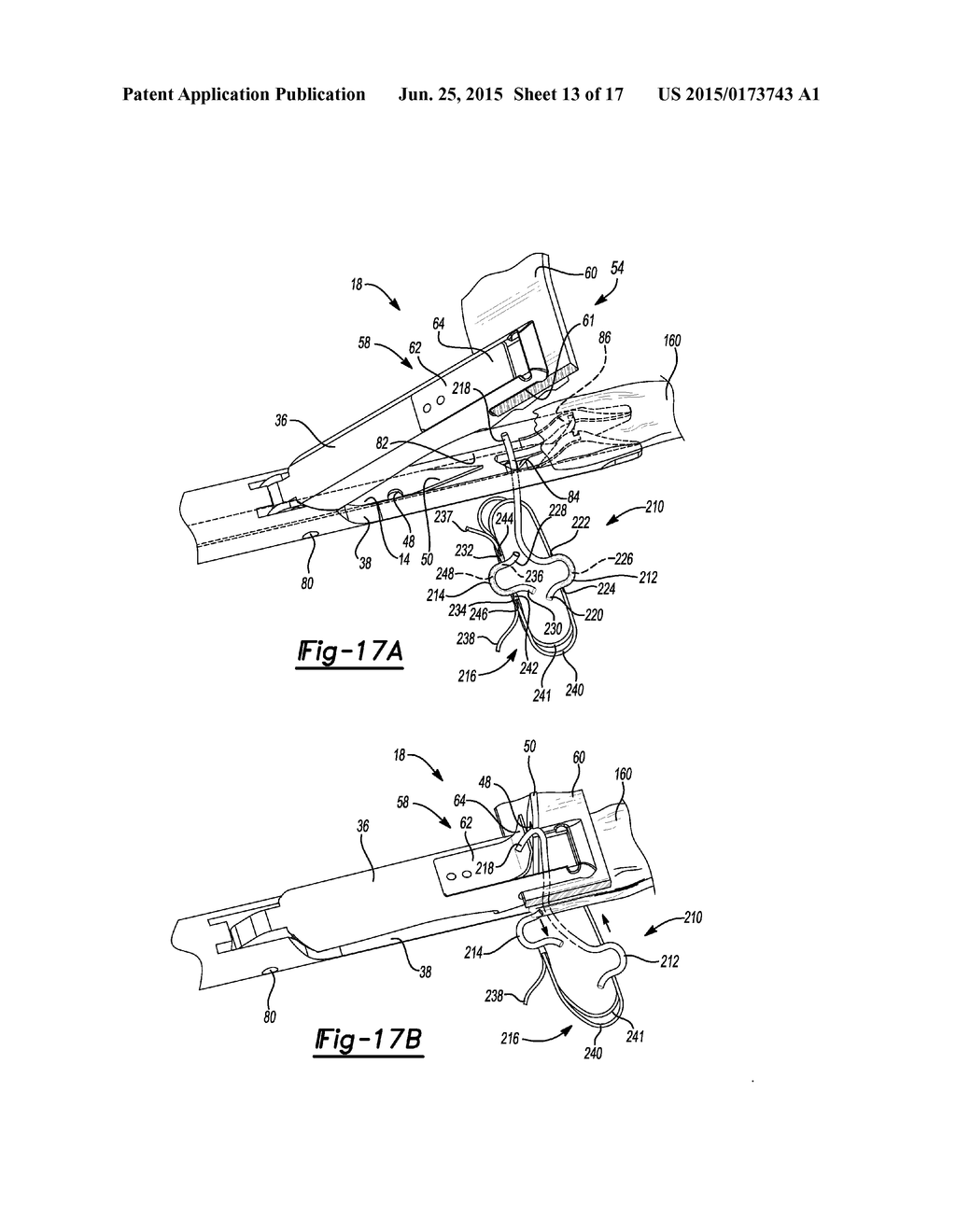 Suture Passer With Tissue Reinforcement Positioner - diagram, schematic, and image 14