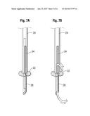 SELF-CINCHING SURGICAL CLIPS AND DELIVERY SYSTEM diagram and image