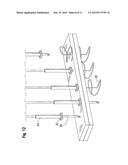 SELF-CINCHING SURGICAL CLIPS AND DELIVERY SYSTEM diagram and image