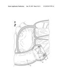 SELF-CINCHING SURGICAL CLIPS AND DELIVERY SYSTEM diagram and image