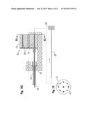 SELF-CINCHING SURGICAL CLIPS AND DELIVERY SYSTEM diagram and image