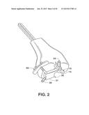 INSTRUMENTS FOR MINIMALLY INVASIVE SURGERY TOTAL KNEE ARTHROPLASTY diagram and image