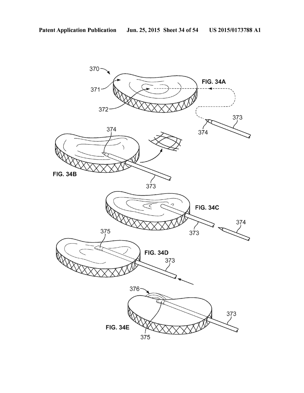 MINIATURE SHREDDING TOOL FOR USE IN MEDICAL APPLICATIONS AND METHODS FOR     MAKING - diagram, schematic, and image 35