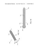 SPINE SYSTEM AND KIT diagram and image