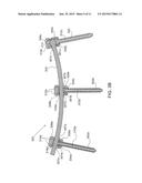 SPINE SYSTEM AND KIT diagram and image