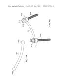 SPINE SYSTEM AND KIT diagram and image