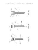 SPINE SYSTEM AND KIT diagram and image