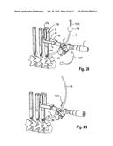 ROD INSERTION DEVICE diagram and image