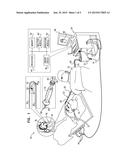 TORSION REDUCTION SYSTEM diagram and image