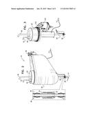 TORSION REDUCTION SYSTEM diagram and image