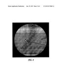 IMAGING FIDUCIAL MARKERS AND METHODS diagram and image