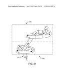 VAGINAL INSERT METHOD OF MANUFACTURE diagram and image