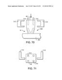 VAGINAL INSERT METHOD OF MANUFACTURE diagram and image