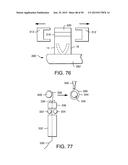 VAGINAL INSERT METHOD OF MANUFACTURE diagram and image