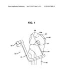 METHODS FOR LIGAMENT RECONSTRUCTION diagram and image