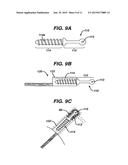 METHODS FOR LIGAMENT RECONSTRUCTION diagram and image