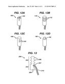 METHODS FOR LIGAMENT RECONSTRUCTION diagram and image