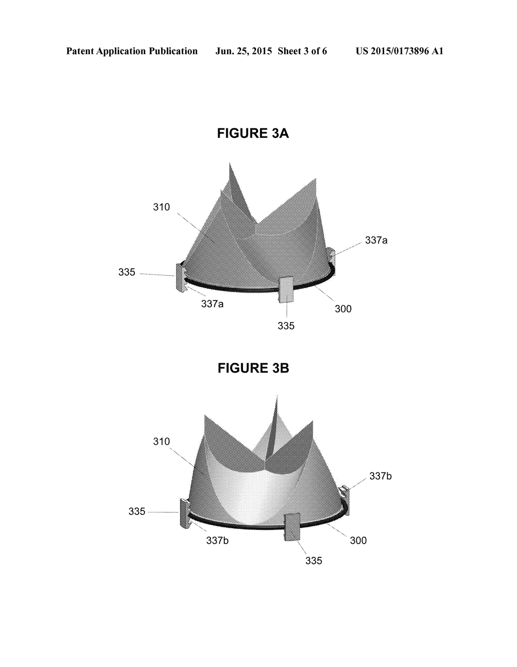 METHOD AND APPARATUS FOR FINE ADJUSTMENT OF A PERCUTANEOUS VALVE STRUCTURE - diagram, schematic, and image 04