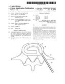 IN-SITU FORMED INTERVERTEBRAL FUSION DEVICE AND METHOD diagram and image